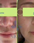 Contorno de ojos con pentapéptidos, 10 ml