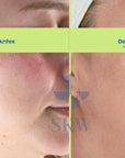 Serum Revitalizante con células madre Antiedad, 30 ml